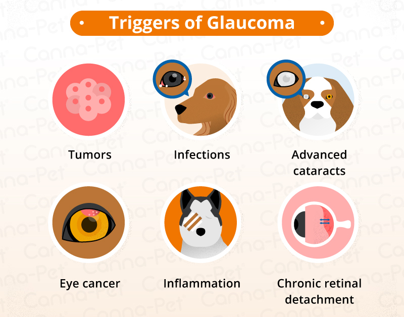 triggers of glaucoma